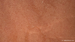 &nbsp;